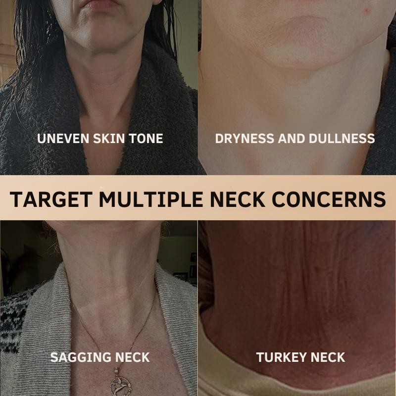 Peptide Neck Smoother for Crepey & Sagging Skin